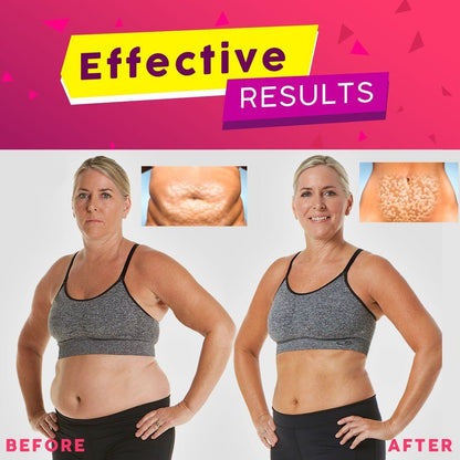 Exotone™️ Body Slimming Spray