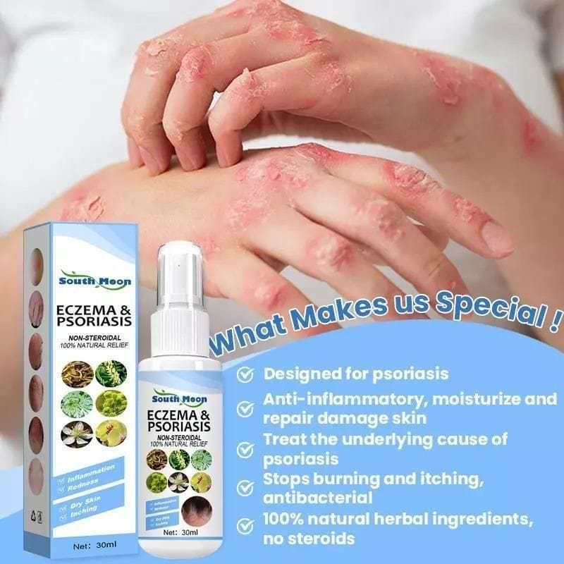 Herbal Psoriasis Relief Spray (Pack Of 2)